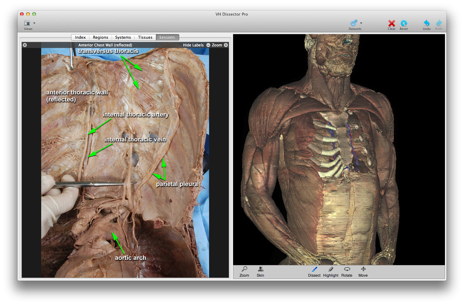 Download human anatomy 3d software